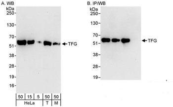 Rabbit TFG Antibody