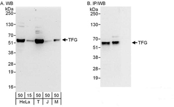 Rabbit TFG Antibody