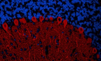Rabbit IP3R1 Antibody