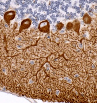 Rabbit IP3R1 Antibody