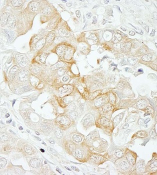 Rabbit Notch2 Antibody
