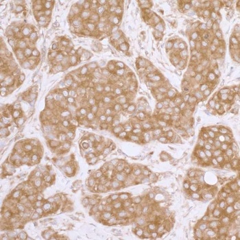 Rabbit eIF3A/eIF3S10 Antibody