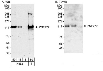 Rabbit ZNF777 Antibody