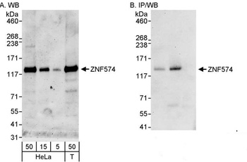 Rabbit ZNF574 Antibody