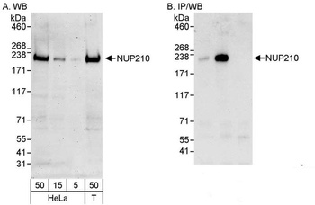 Rabbit NUP210 Antibody