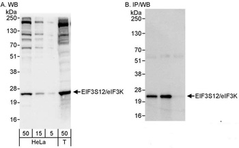 Rabbit eIF3K/EIF3S12 Antibody