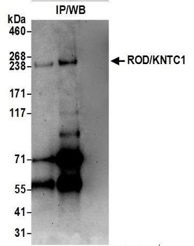Rabbit ROD/KNTC1 Antibody