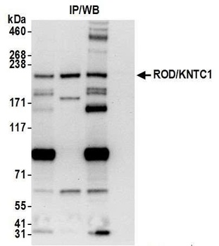 Rabbit ROD/KNTC1 Antibody