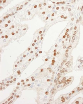 Rabbit KPNA4 Antibody