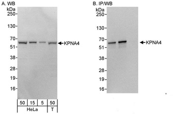Rabbit KPNA4 Antibody