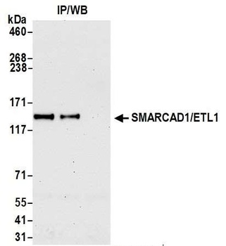 Rabbit SMARCAD1/ETL1 Antibody
