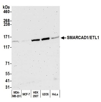 Rabbit SMARCAD1/ETL1 Antibody