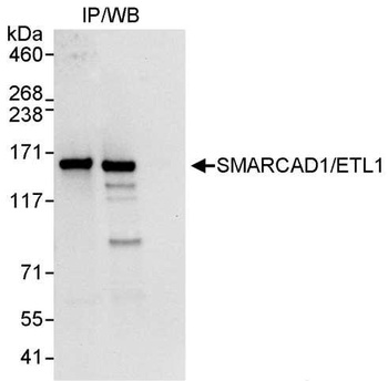 Rabbit SMARCAD1/ETL1 Antibody