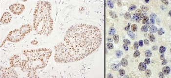 Rabbit Rtf1 Antibody