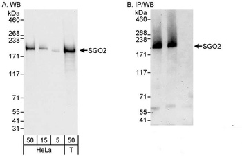 Rabbit SGO2 Antibody