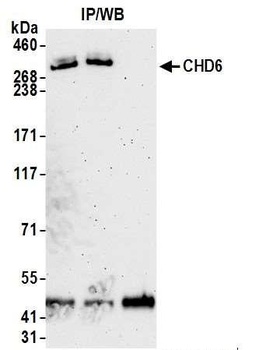 Rabbit CHD6 Antibody