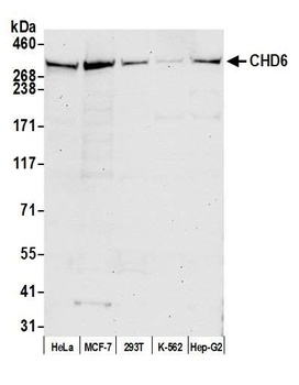 Rabbit CHD6 Antibody