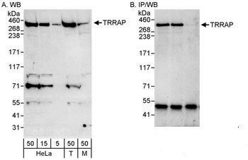 Rabbit TRRAP Antibody