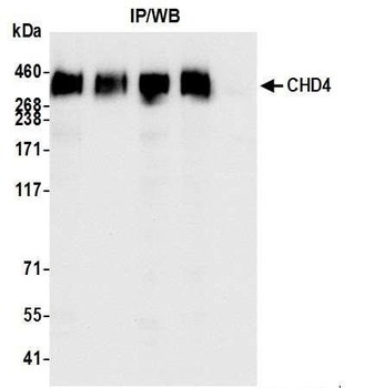 Rabbit CHD4 Antibody