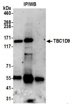 Rabbit TBC1D9 Antibody