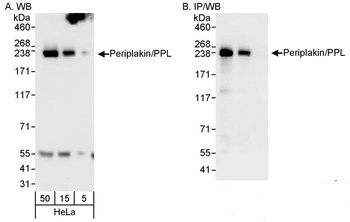 Rabbit Periplakin/PPL Antibody