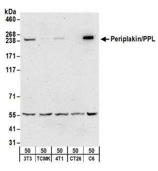 Rabbit Periplakin/PPL Antibody