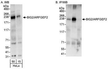 Rabbit BIG2/ARFGEF2 Antibody