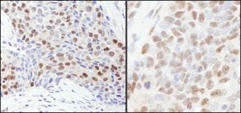 Rabbit RbBP7 Antibody