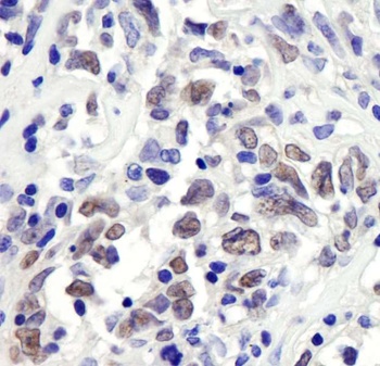 Rabbit RbBP7 Antibody