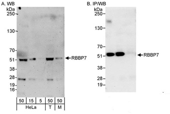 Rabbit RbBP7 Antibody