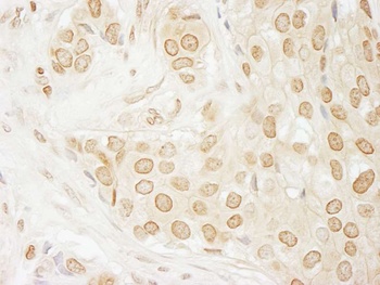 Rabbit USP33 Antibody