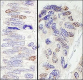 Rabbit Pescadillo Antibody