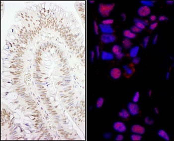 Rabbit PPP4R3 Alpha Antibody