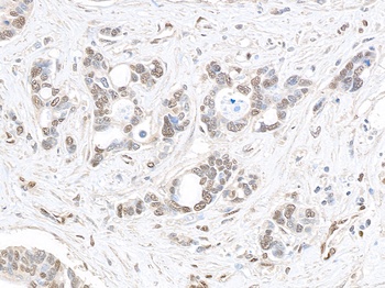 Rabbit MED1 Antibody