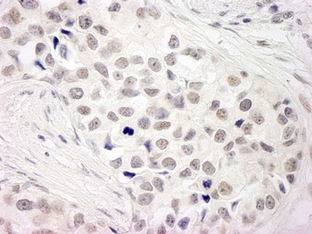 Rabbit NCOA5/CIA Antibody
