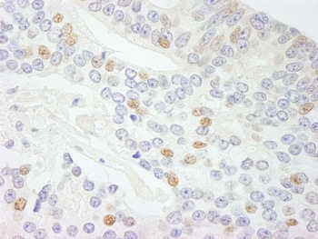 Rabbit NCOA5/CIA Antibody