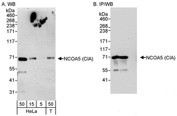 Rabbit NCOA5/CIA Antibody