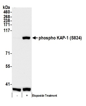 Rabbit Phospho KAP-1 (S824) Antibody