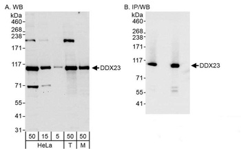 Rabbit DDX23 Antibody
