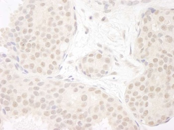 Rabbit DDX23 Antibody