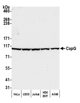 Rabbit CAP-G Antibody