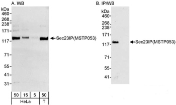 Rabbit Sec23IP/MSTP053 Antibody