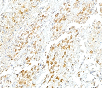 Rabbit VCP Antibody