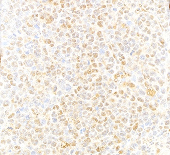 Rabbit VCP Antibody