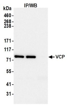 Rabbit VCP Antibody