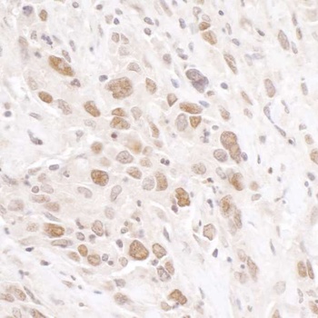 Rabbit RIF1 Antibody