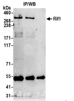 Rabbit RIF1 Antibody