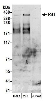 Rabbit RIF1 Antibody