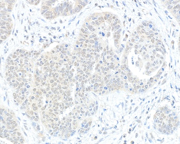 Rabbit RIF1 Antibody