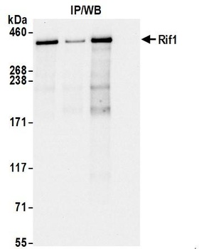Rabbit RIF1 Antibody